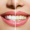 Health & Fitness - Teeth Whitening Tips - Learn How to Whiten Teeth - Nick Lim