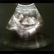 Health & Fitness - Full Term - Labor Contraction Timer