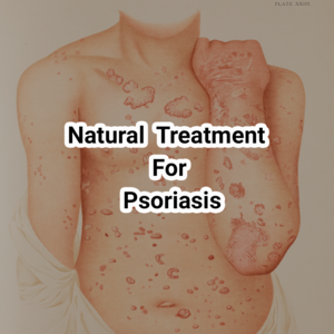 Health & Fitness - Natural treatments for psoriasis and psoriatic arthritis - TrainTech USA